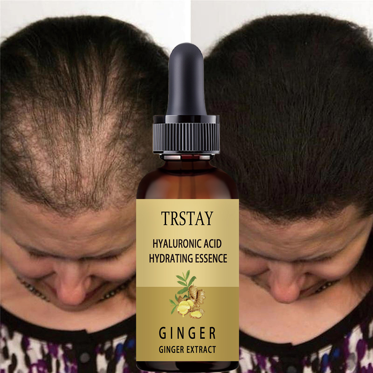 Hair Care Serum - Hair Growth Serum Anti Preventing Hair
