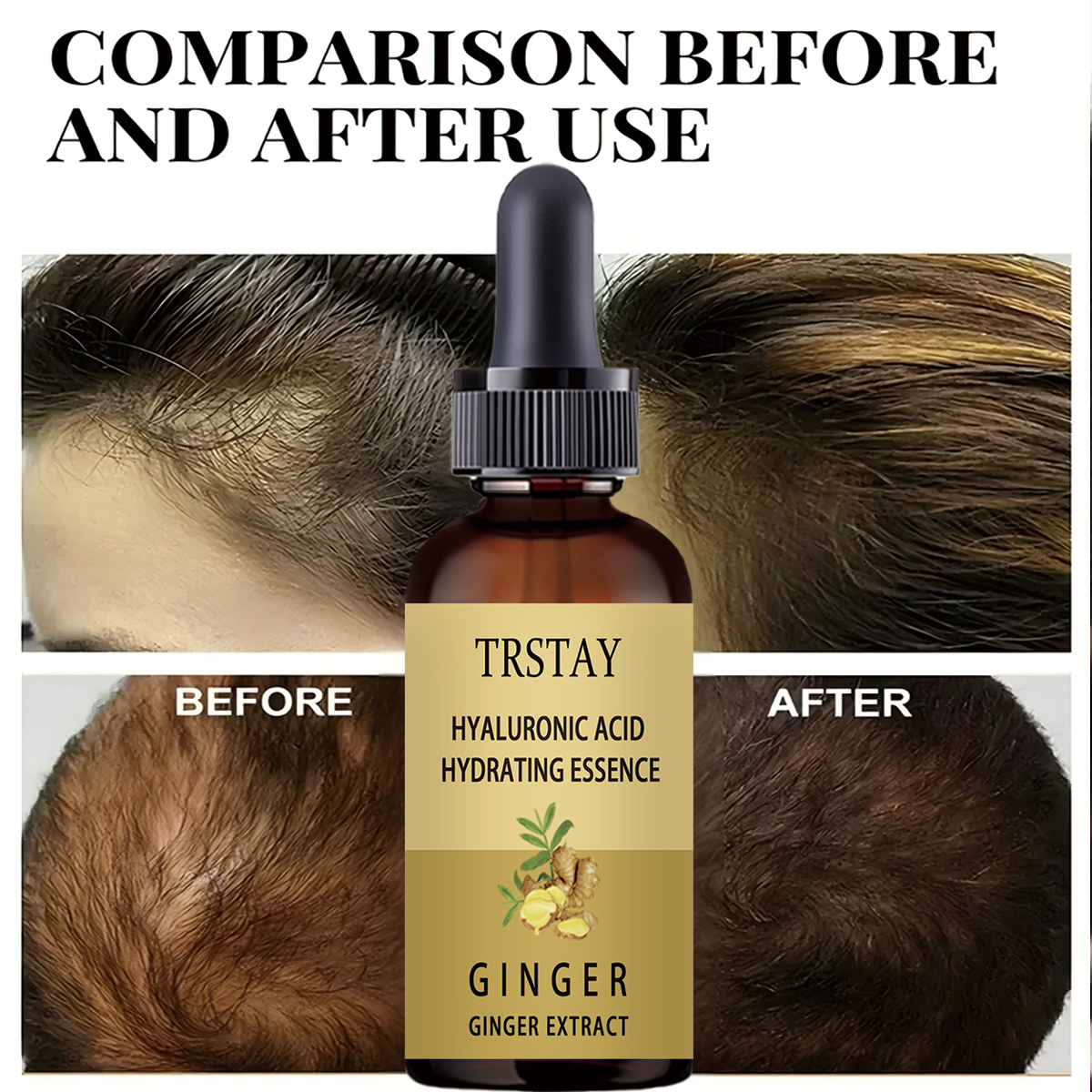Hair Growth Serum Anti Prevent - đánh giá và giá Hair Care Serum