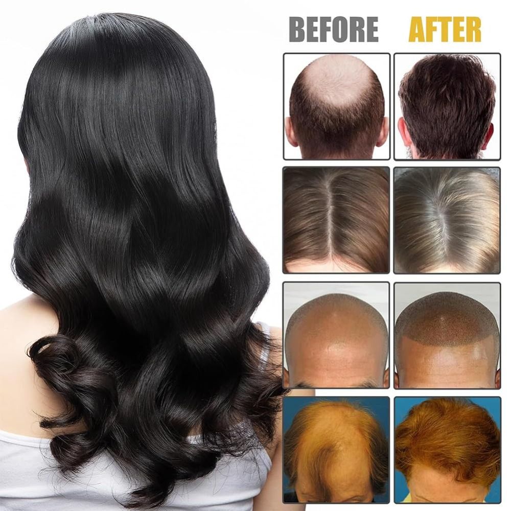 New Nourishes Hair Roots Vorte - đánh giá và giá Hair Care Formulation