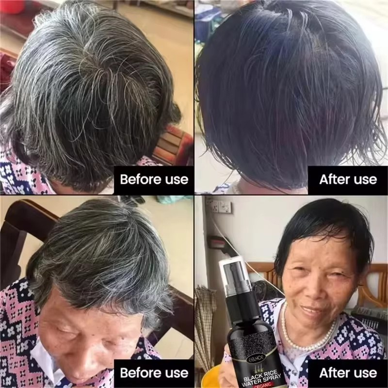 Gray White Hair Treatment Seru - đánh giá và giá Hair Care Ginseng
