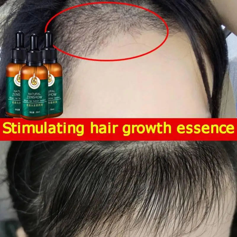 Ginger Hair Growth Essential O - đánh giá và giá Hair Care Herbal Products