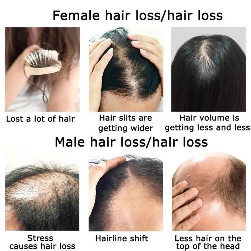 Ginger Hair Growth Essential O - đánh giá và giá Hair Care Herbal Products