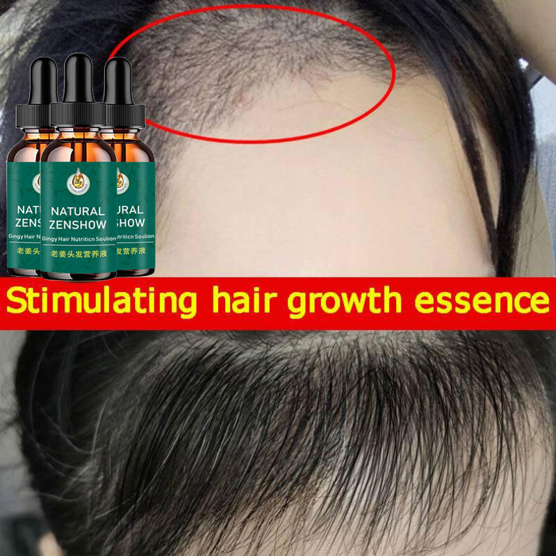 Gừng Mọc Tóc Tinh Dầu Tóc Thảo - đánh giá và giá Hair Care Herbal Products