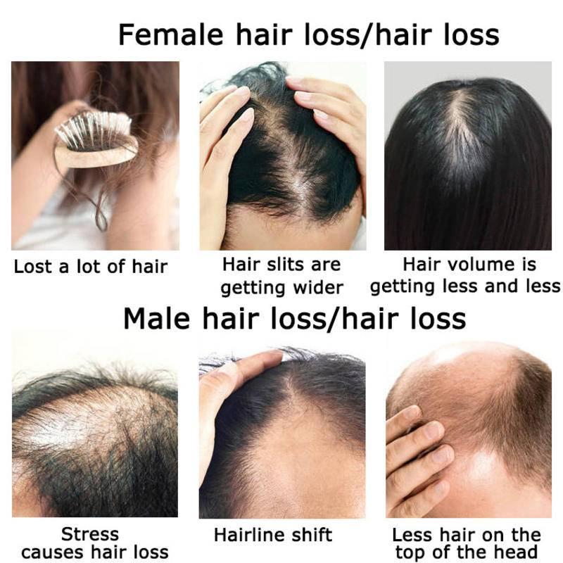 Gừng Mọc Tóc Tinh Dầu Tóc Thảo - đánh giá và giá Hair Care Herbal Products