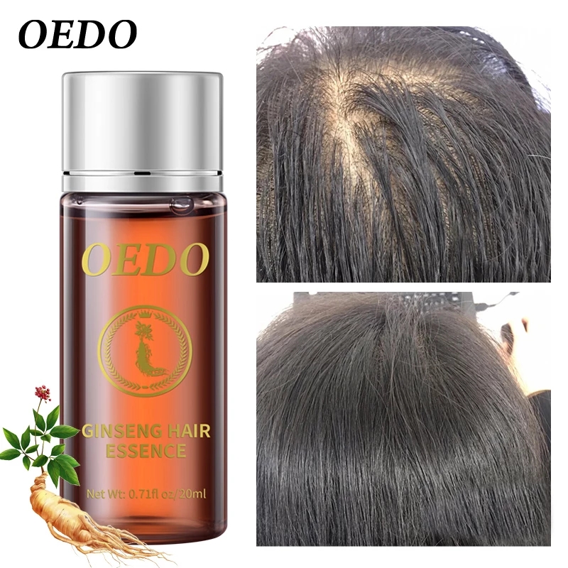 20ML Ginseng Hair Growth Essen - đánh giá và giá Hair Care Ginseng