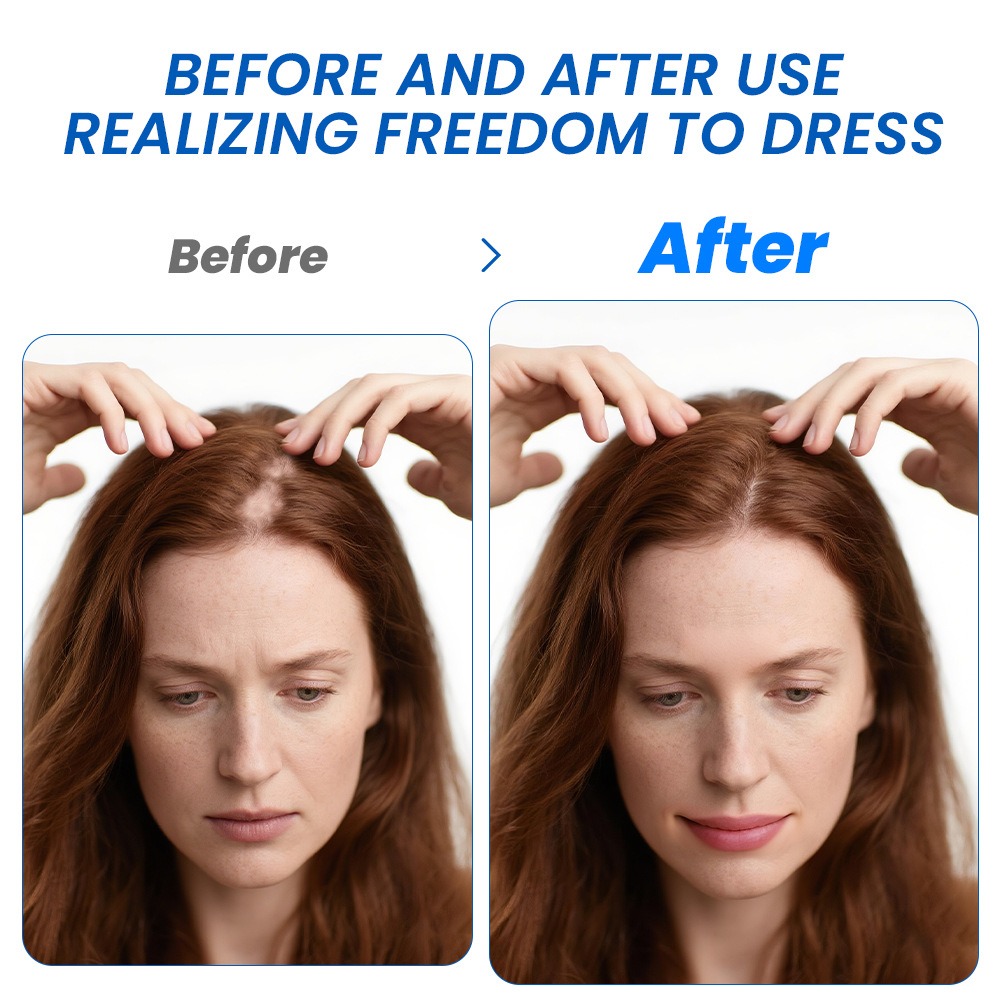 Alopecia Hair Growth Spray Sop - đánh giá và giá Hair Care Spray