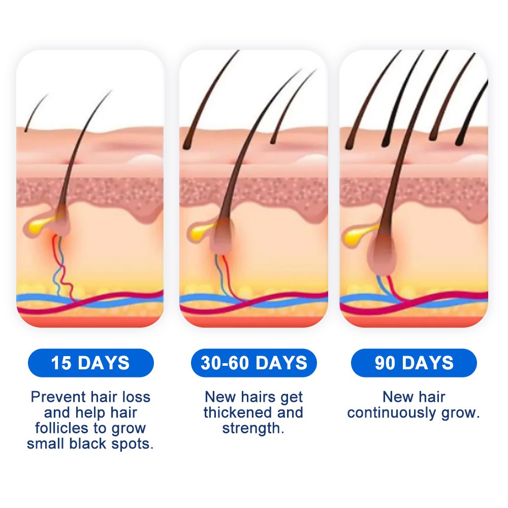 Alopecia Hair Growth Spray Sop - đánh giá và giá Hair Care Spray