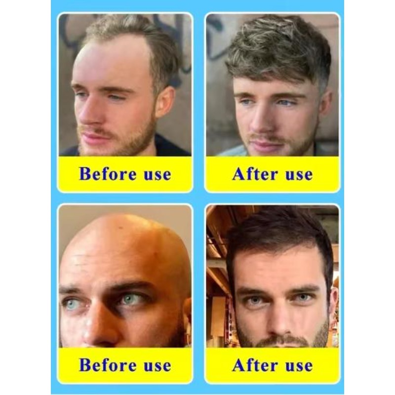 Biotin Collagen Hair Care Esse - đánh giá và giá Hair Care Collagen