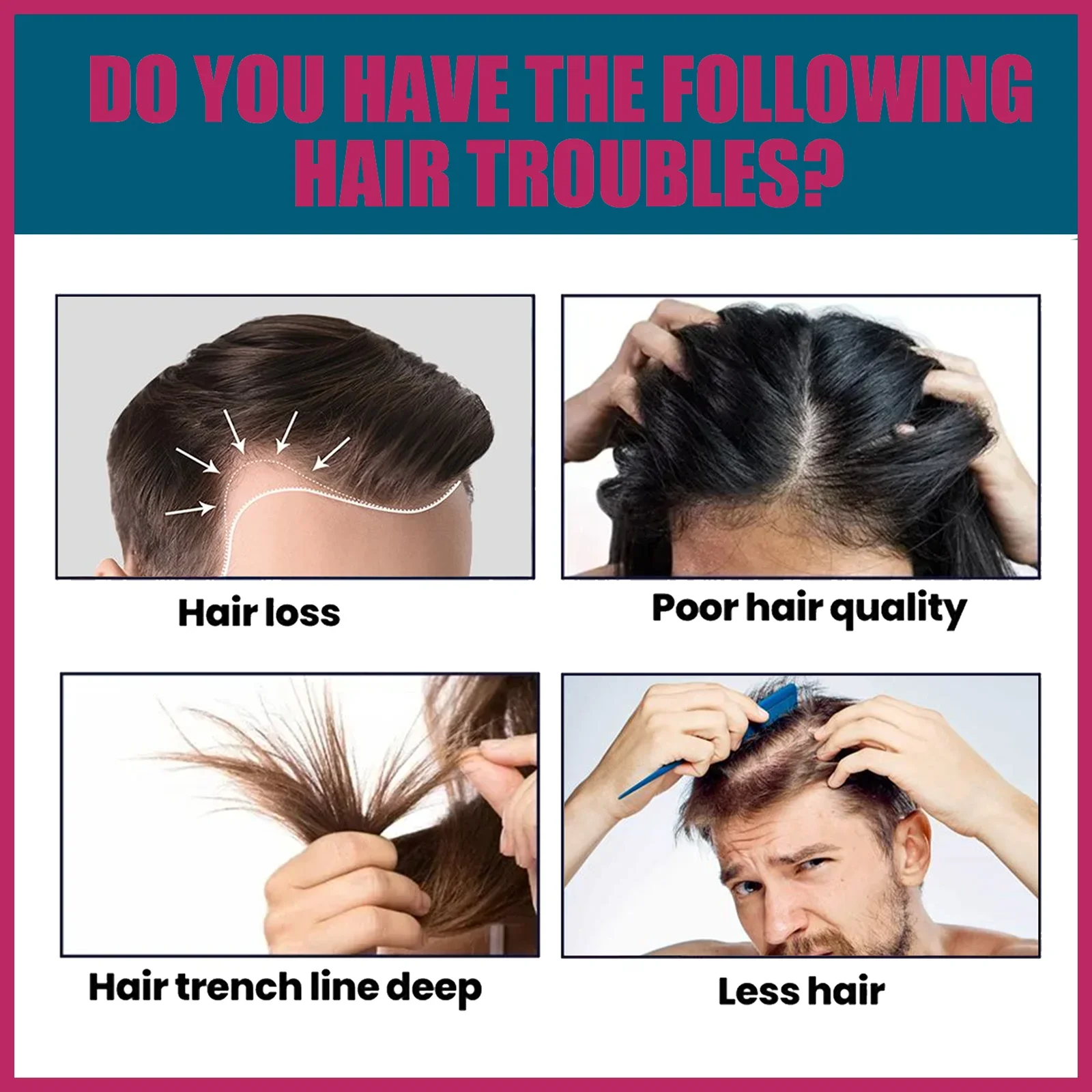 Biotin Collagen Hair Care Esse - đánh giá và giá Hair Care Collagen