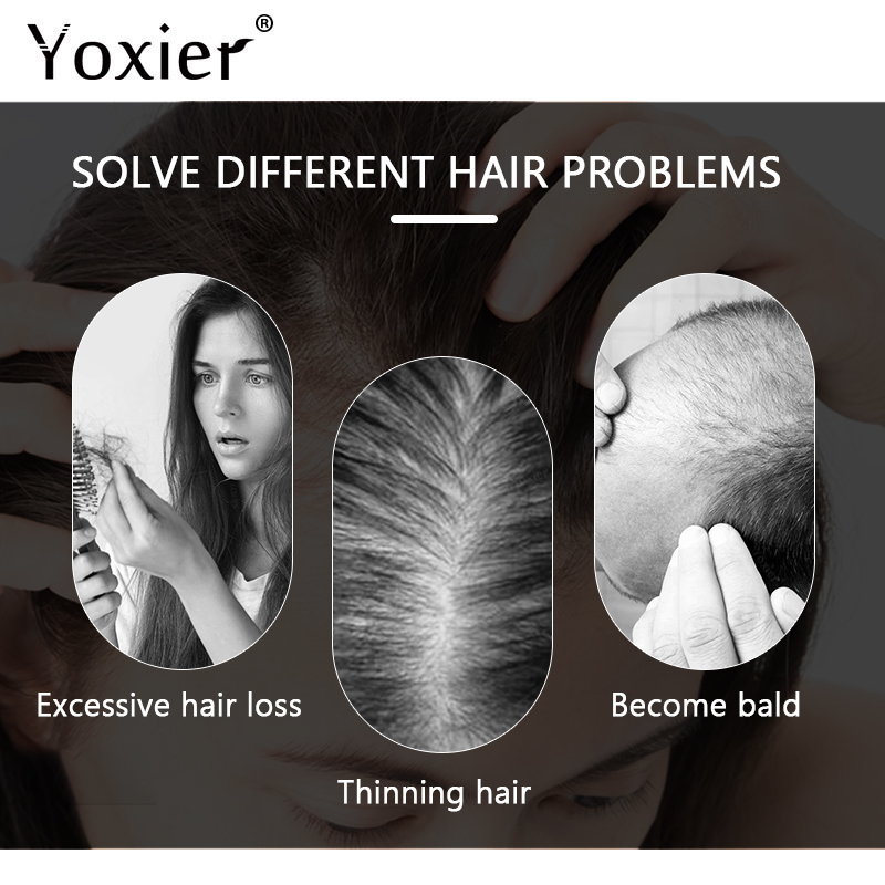 Chuyên Sâu Serum Kích Kem Ngăn - đánh giá và giá Hair Care Serum