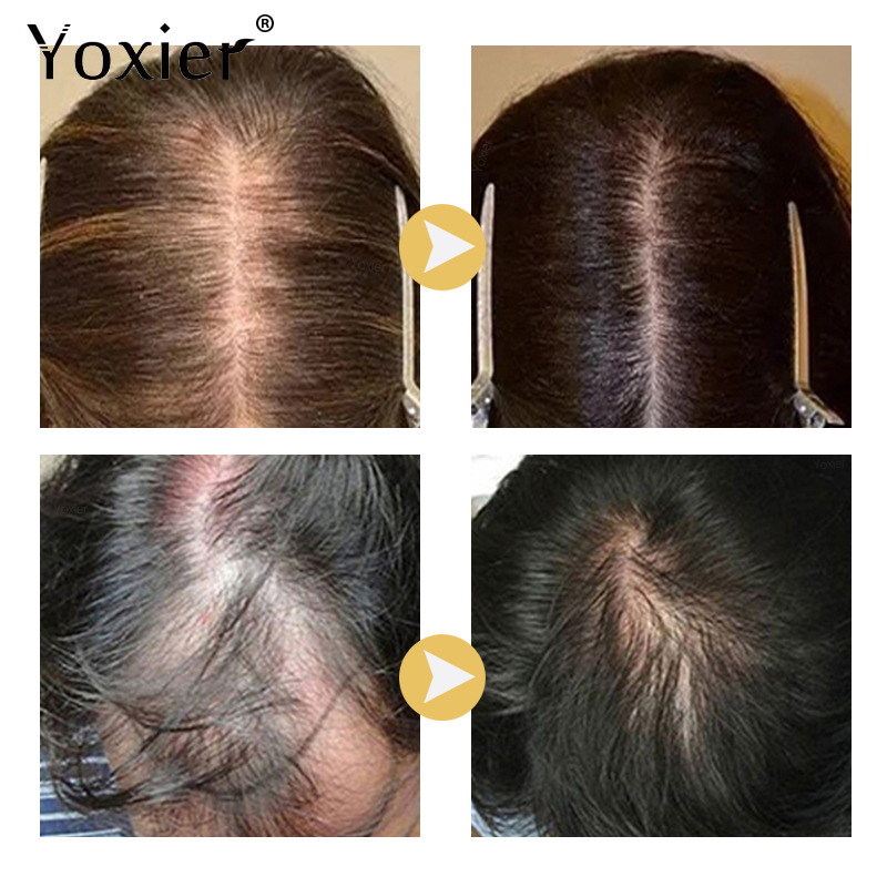 Chuyên Sâu Serum Kích Kem Ngăn - đánh giá và giá Hair Care Serum