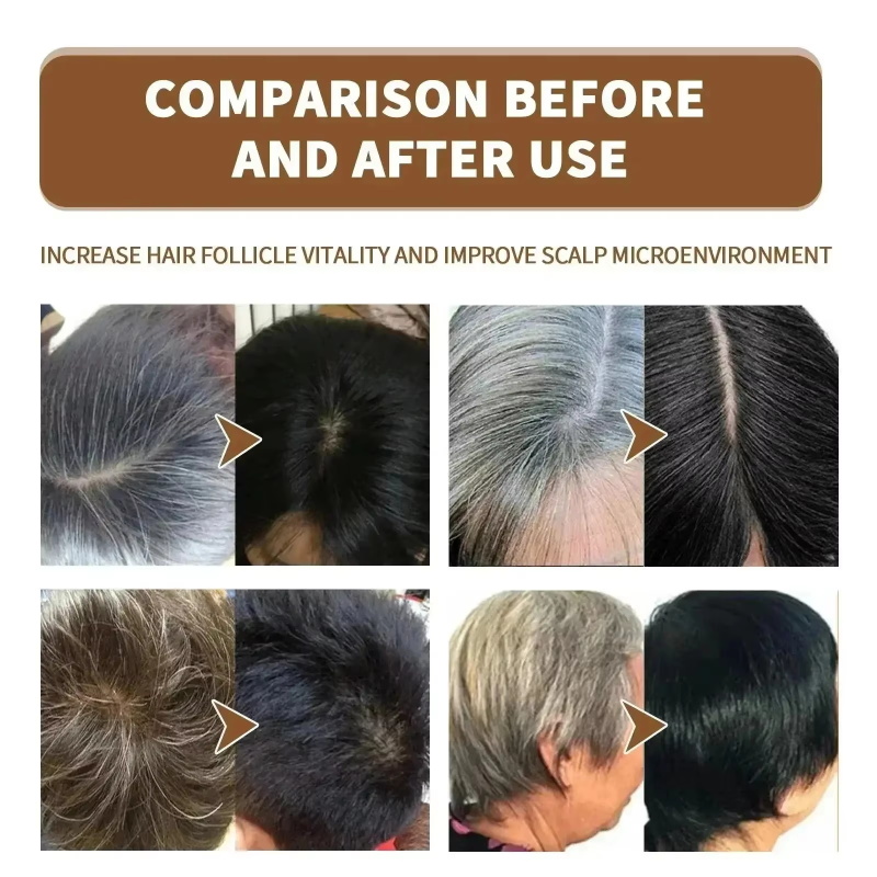 Herbal Anti-grey Treatment Hai - đánh giá và giá Hair Care Herbal Products