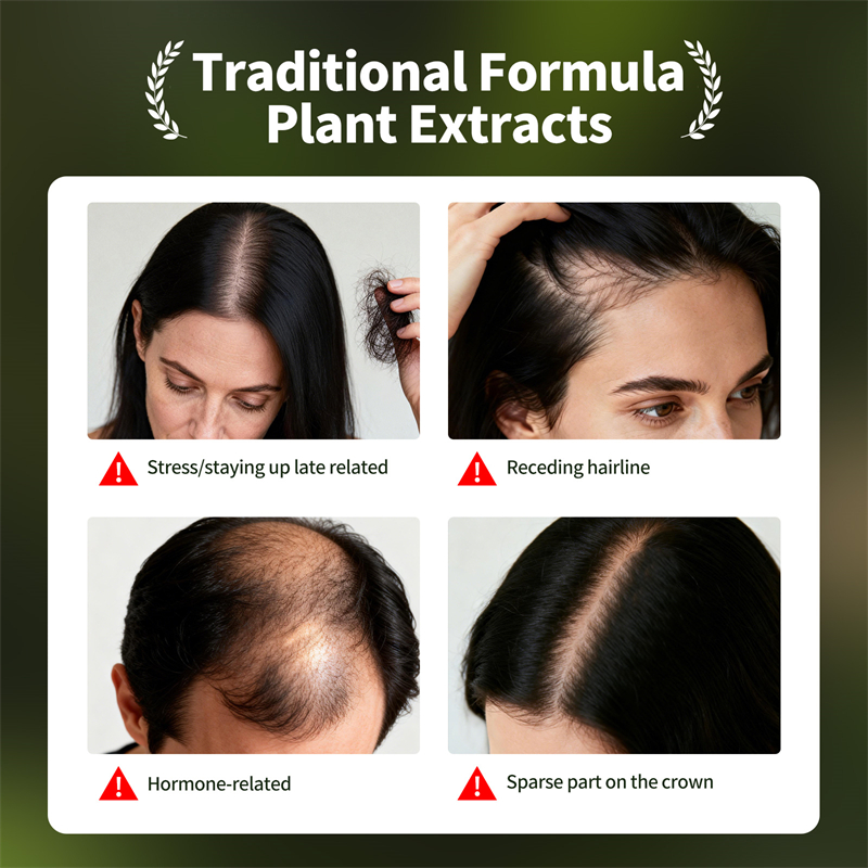 Natural Hair Growth Set Usman  - đánh giá và giá Hair Care Herbal Products