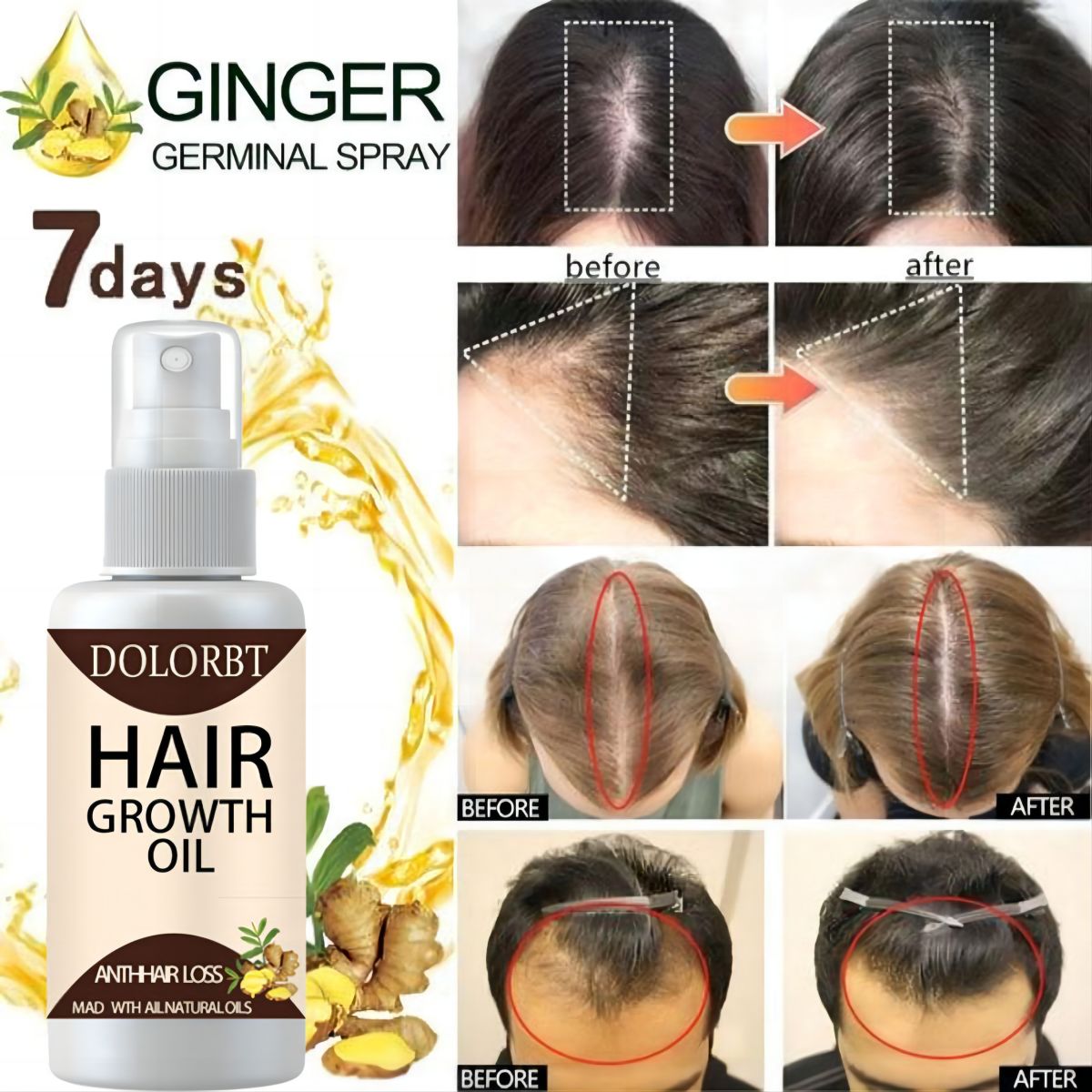 Mọc Tóc Tinh Chất Dầu Xịt Thảo - đánh giá và giá Hair Care Herbal Products