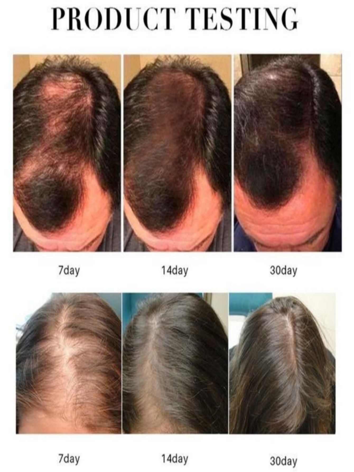 Mọc Tóc Tinh Chất Dầu Xịt Thảo - đánh giá và giá Hair Care Herbal Products