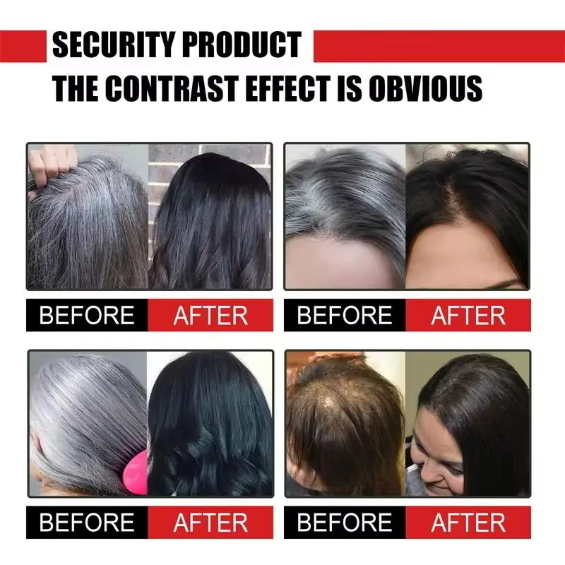 Herbal Anti-grey Hair Treatmen - đánh giá và giá Hair Care Herbal Products