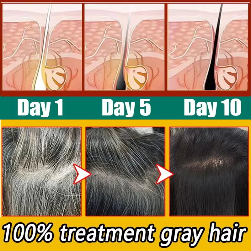 Herbal Anti-grey Hair Treatmen - đánh giá và giá Hair Care Herbal Products