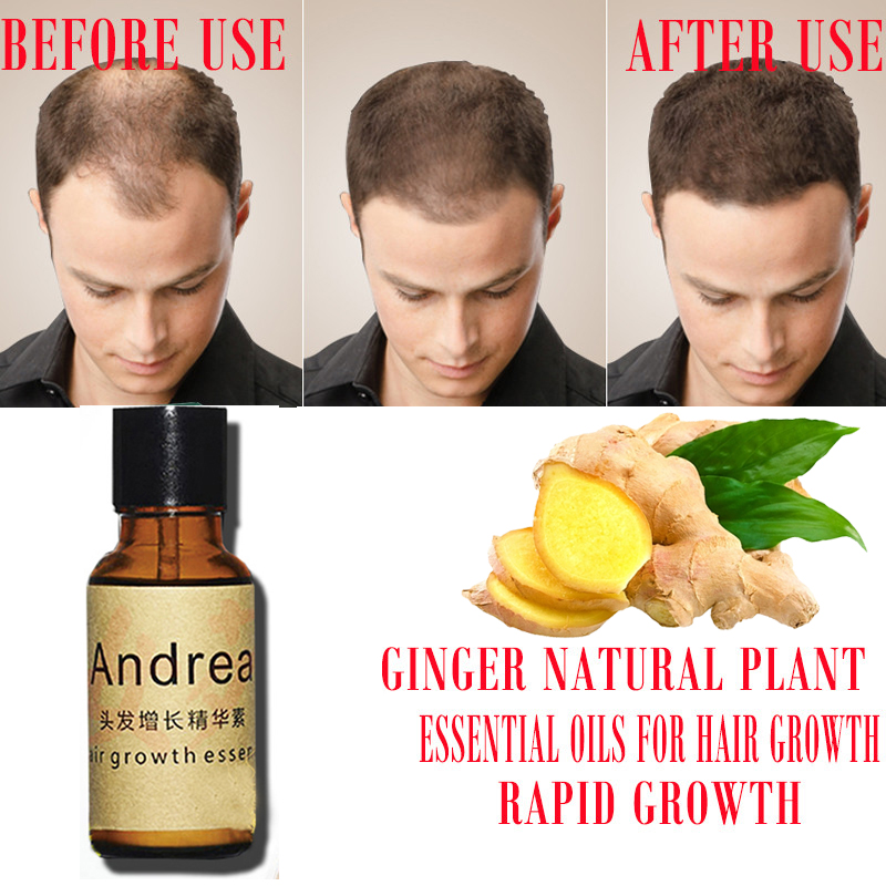 2/5/10Pcs Andrea Hair Growth S - đánh giá và giá Hair Care Herbal Products