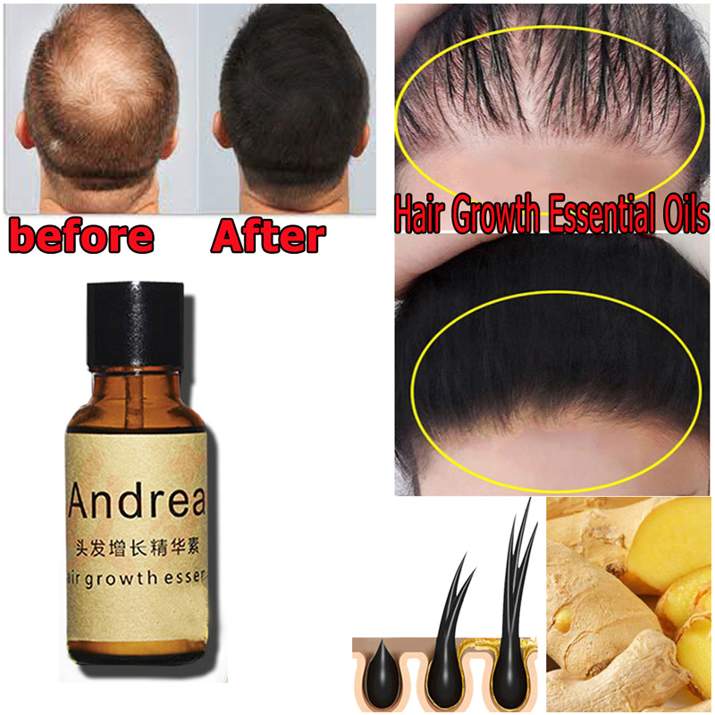 2/5/10Pcs Andrea Hair Growth S - đánh giá và giá Hair Care Herbal Products